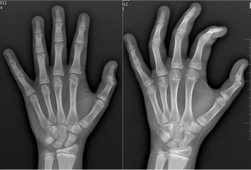 83c5573e629710a773d3ff3b544cde6a